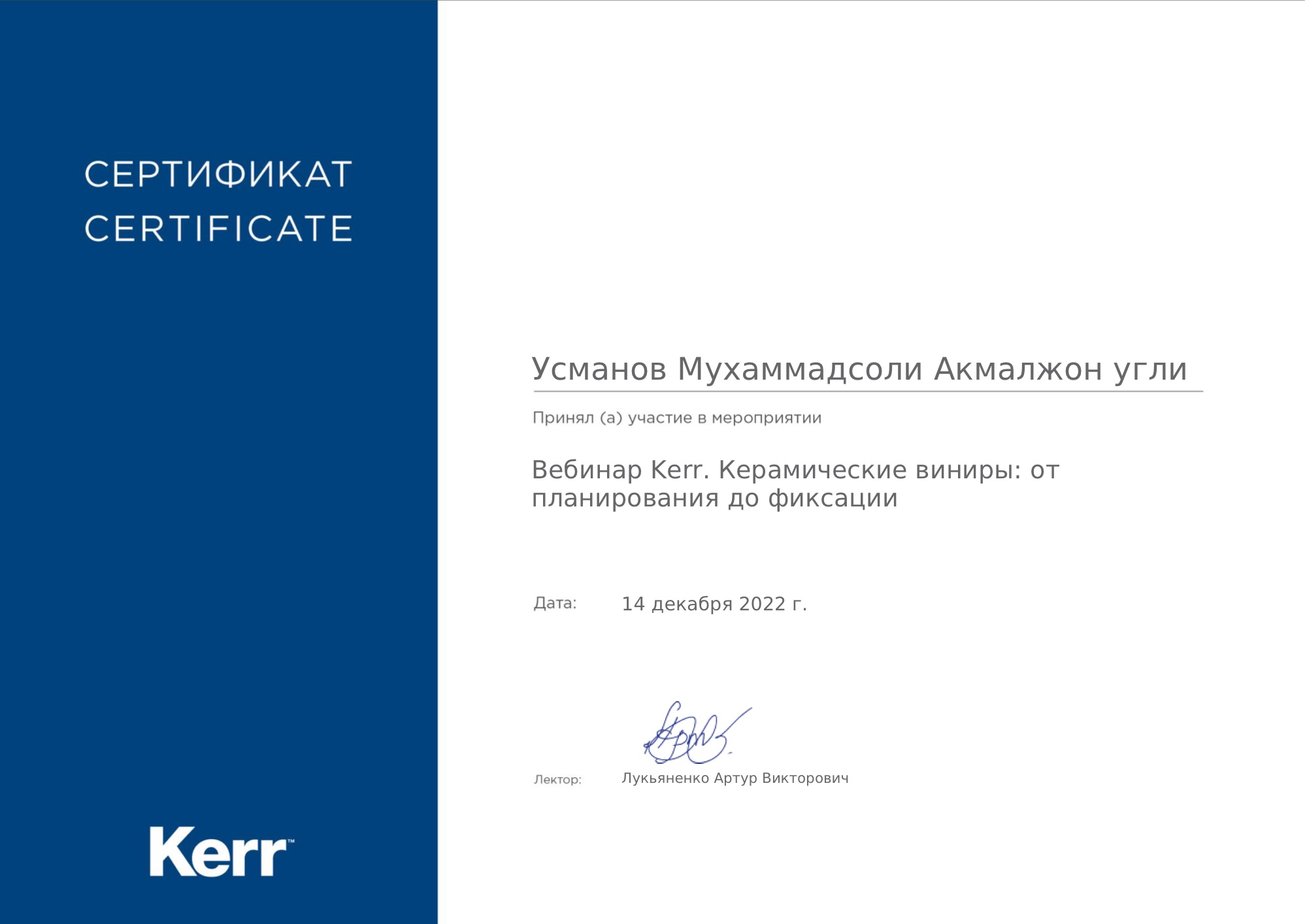 Керамические виниры